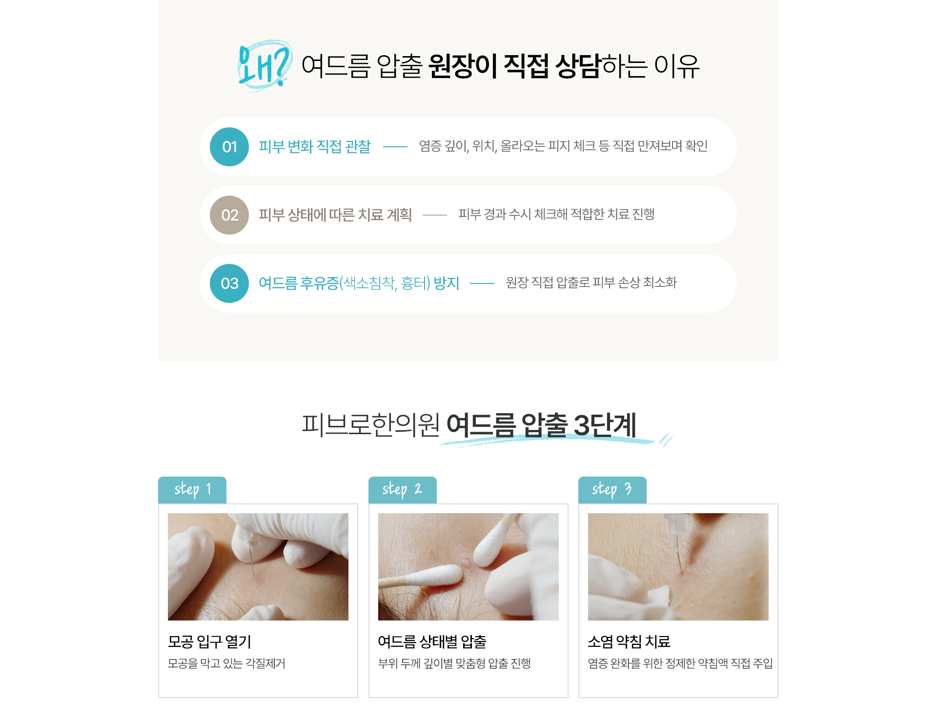여드름 치료