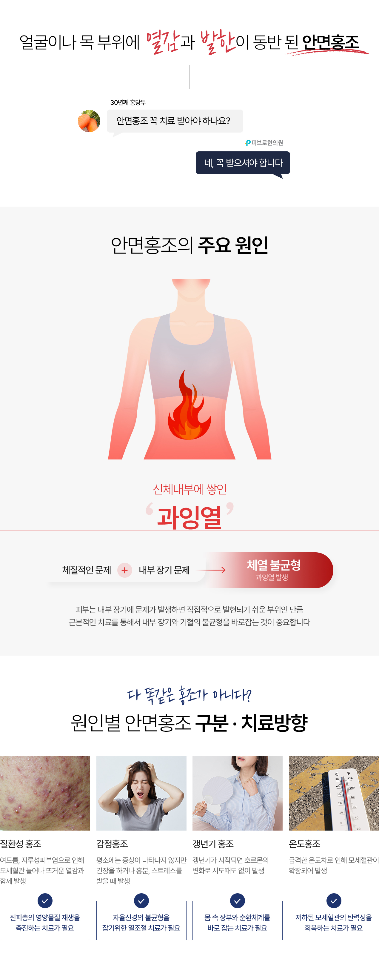 안면홍조 치료